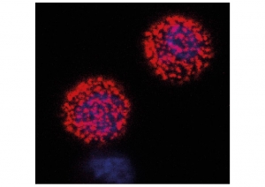 Brněn&scaron;t&iacute; hematologov&eacute; d&iacute;ky nejnověj&scaron;&iacute;m metod&aacute;m l&eacute;pe rozpoznaj&iacute; rakovinu krve